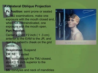 Axiolateral Oblique Projection
Px Position: semi prone or seated
In TMJ examinations, make one
exposure with the mouth closed and,
when not contraindicated, one
exposure with the mouth open.
Part Position:
Center a point 1'2 inch ( 1 .3 cm)
anterior to the EAM to the JR, and
rest the patient‘s cheek on the grid
device.
Respiration: Suspend
CR: 15° caudad
RP: exits through the TMJ closest,
about 1 ½ inch superior to the
upside EAM
SS: condyles and neck of mandibles
 