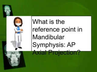 What is the
reference point in
Mandibular
Symphysis: AP
Axial Projection?
 