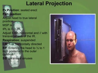 Lateral Projection
Px Position: seated erect
Part position:
Adjust head to true lateral
position.
MSP is //
IPL is ┴ to IR
Adjust IOML horizontal and // with
transverse axis of the IR.
Respiration: suspended
CR: ┴ or horizontally directed
RP: Entering the head to ½ to 1
inch posterior to the outer
canthus.
SS: paranasal sinuses
 