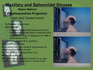Maxillary and Sphenoidal Sinuses
Waters Method
Parietoacanthial Projection
Open and Closed mouth
• Px Position: seated erect.
• Part position:
– Center and adjust MSP perpendicular to IR,
and have patient rest head on extended neck.
– Adjust OML to form 37 degrees to IR. MML is
perpendicular to IR
Center IR to acanthion.
OPEN MOUTH OPTION:
Have patient fully open mouth to demonstrate the
sphenoid and maxillary sinuses.
CR: Horizontal and perpendicular to IR.
RP: exiting acanthion
SS: sphenoidal and maxillary sinuses for an open
mouth and maxillary sinuses for a closed mouth.
 