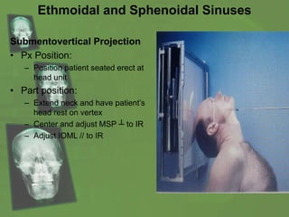 Ethmoidal and Sphenoidal Sinuses
Submentovertical Projection
• Px Position:
– Position patient seated erect at
head unit
• Part position:
– Extend neck and have patient’s
head rest on vertex
– Center and adjust MSP ┴ to IR
– Adjust IOML // to IR
 