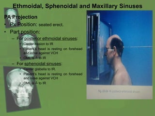 Ethmoidal, Sphenoidal and Maxillary Sinuses
PA Projection
• Px Position: seated erect.
• Part position:
– For posterior ethmoidal sinuses:
• Center nasion to IR
• Patient’s head is resting on forehead
and nose against VCH
• OML is ┴ to IR
– For sphenoidal sinuses:
• Center glabella to IR.
• Patient’s head is resting on forehead
and nose against VCH
• OML is ┴ to IR
 