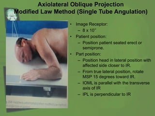 Axiolateral Oblique Projection
Modified Law Method (Single Tube Angulation)
• Image Receptor:
– 8 x 10’’
• Patient position:
– Position patient seated erect or
semiprone.
• Part position:
– Position head in lateral position with
affected side closer to IR.
– From true lateral position, rotate
MSP 15 degrees toward IR.
– IOML is parallel with the transverse
axis of IR
– IPL is perpendicular to IR
 