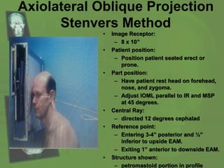 Axiolateral Oblique Projection
Stenvers Method
• Image Receptor:
– 8 x 10’’
• Patient position:
– Position patient seated erect or
prone.
• Part position:
– Have patient rest head on forehead,
nose, and zygoma.
– Adjust IOML parallel to IR and MSP
at 45 degrees.
• Central Ray:
– directed 12 degrees cephalad
• Reference point:
– Entering 3-4” posterior and ½”
inferior to upside EAM.
– Exiting 1” anterior to downside EAM.
• Structure shown:
– petromastoid portion in profile
 