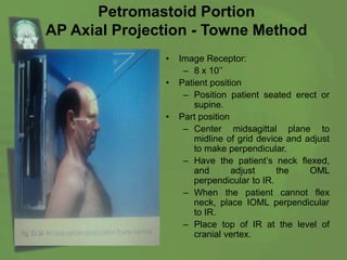Petromastoid Portion
AP Axial Projection - Towne Method
• Image Receptor:
– 8 x 10’’
• Patient position
– Position patient seated erect or
supine.
• Part position
– Center midsagittal plane to
midline of grid device and adjust
to make perpendicular.
– Have the patient’s neck flexed,
and adjust the OML
perpendicular to IR.
– When the patient cannot flex
neck, place IOML perpendicular
to IR.
– Place top of IR at the level of
cranial vertex.
 