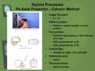 Styloid Processes
PA Axial Projecton - Cahoon Method
• Image Receptor:
– 8 x 10’’
• Patient position:
– Patient in seated-upright or prone
position.
• Part position:
– Patient’s head resting on the forehead
and nose.
– MSP perpendicular to IR.
– OML perpendicular to IR.
• Central Ray:
– directed at angle of 25 cephalad
• Reference point:
– nasion
• Structure shown:
– styloid process
 