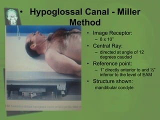 • Hypoglossal Canal - Miller
Method
• Image Receptor:
– 8 x 10’’
• Central Ray:
– directed at angle of 12
degrees caudad
• Reference point:
– 1” directly anterior to and ½”
inferior to the level of EAM
• Structure shown:
mandibular condyle
 