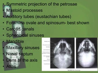 • Symmetric projection of the petrosae
• Mastoid processes
• Auditory tubes (eustachian tubes)
• Foramina ovale and spinosum- best shown
• Carotid canals
• Sphenoidal sinuses
• Mandible
• Maxillary sinuses
• Nasal septum
• Dens of the axis
• Atlas
 