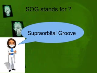 SOG stands for ?
Supraorbital Groove
 