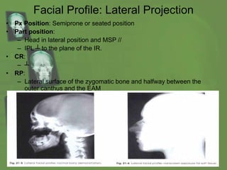 Facial Profile: Lateral Projection
• Px Position: Semiprone or seated position
• Part position:
– Head in lateral position and MSP //
– IPL ┴ to the plane of the IR.
• CR:
– ┴
• RP:
– Lateral surface of the zygomatic bone and halfway between the
outer canthus and the EAM
• SS:
– Bony and Tissue structure
 