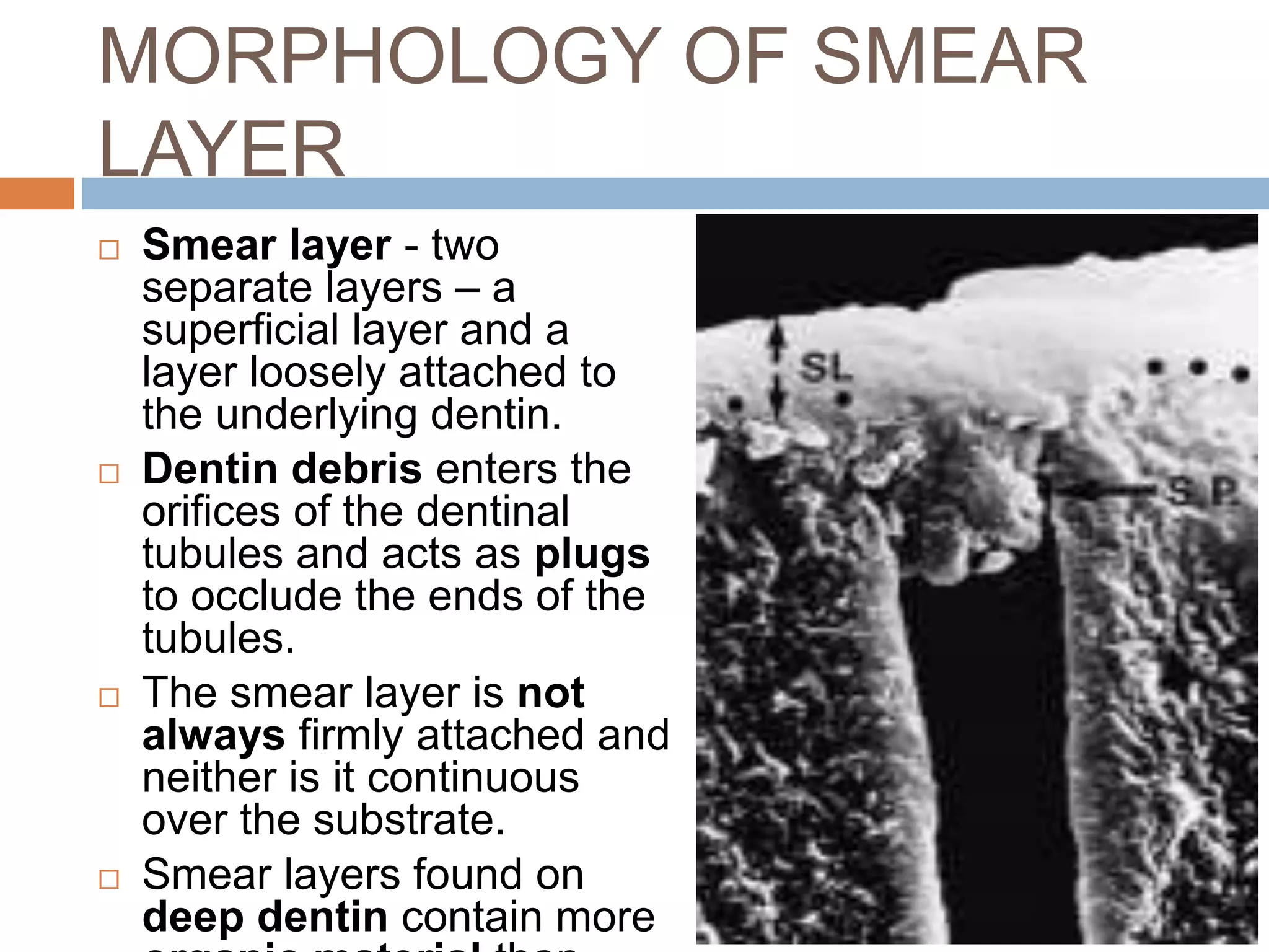 MORPHOLOGY OF SMEAR
LAYER
 Smear layer - two
separate layers – a
superficial layer and a
layer loosely attached to
the underlying dentin.
 Dentin debris enters the
orifices of the dentinal
tubules and acts as plugs
to occlude the ends of the
tubules.
 The smear layer is not
always firmly attached and
neither is it continuous
over the substrate.
 Smear layers found on
deep dentin contain more
 