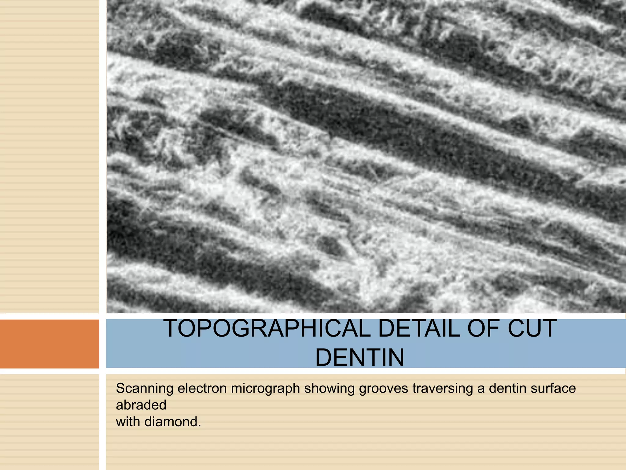 Scanning electron micrograph showing grooves traversing a dentin surface
abraded
with diamond.
TOPOGRAPHICAL DETAIL OF CUT
DENTIN
 