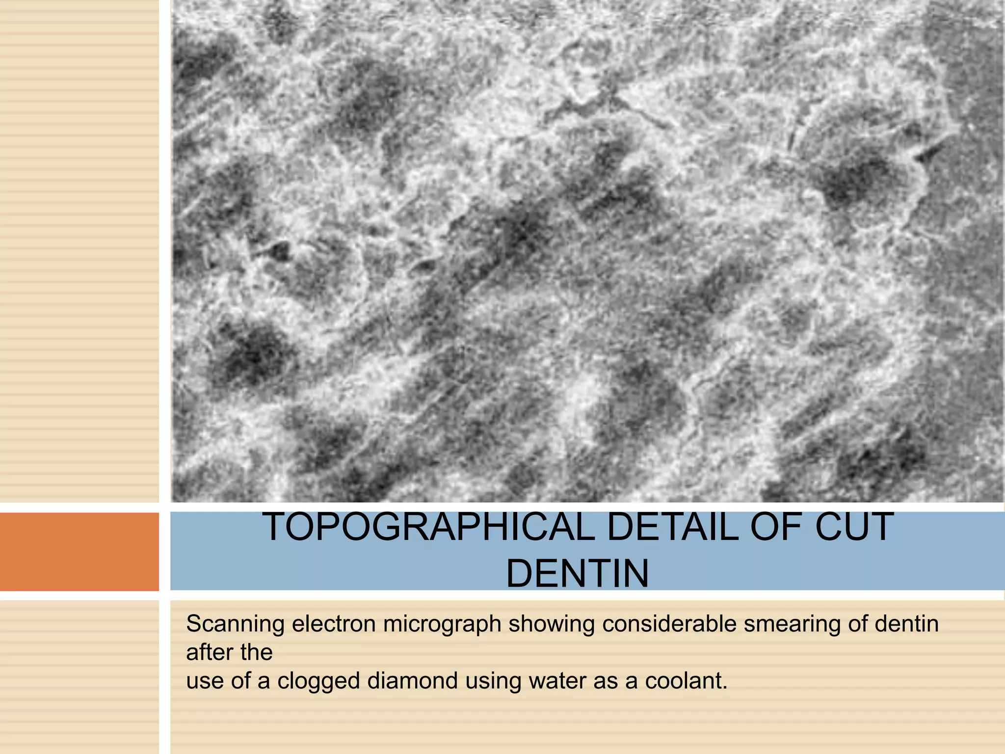Scanning electron micrograph showing considerable smearing of dentin
after the
use of a clogged diamond using water as a coolant.
TOPOGRAPHICAL DETAIL OF CUT
DENTIN
 