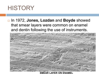 HISTORY
 In 1972, Jones, Lozdan and Boyde showed
that smear layers were common on enamel
and dentin following the use of instruments.
SMEAR LAYER ON ENAMEL
 