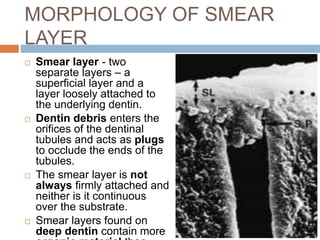 MORPHOLOGY OF SMEAR
LAYER
 Smear layer - two
separate layers – a
superficial layer and a
layer loosely attached to
the underlying dentin.
 Dentin debris enters the
orifices of the dentinal
tubules and acts as plugs
to occlude the ends of the
tubules.
 The smear layer is not
always firmly attached and
neither is it continuous
over the substrate.
 Smear layers found on
deep dentin contain more
 