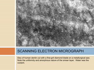 Disc of human dentin cut with a fine-grit diamond blade on a metallurgical saw.
Note the uniformity and amorphous nature of the smear layer. Water was the
coolant.
SCANNING ELECTRON MICROGRAPH
 