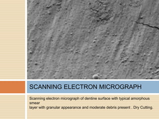 Scanning electron micrograph of dentine surface with typical amorphous
smear
layer with granular appearance and moderate debris present . Dry Cutting.
SCANNING ELECTRON MICROGRAPH
 
