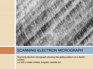 Scanning electron micrograph showing the galling pattern on a dentin
surface
cut with a water-cooled, tungsten carbide bur
SCANNING ELECTRON MICROGRAPH
 