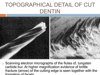  Scanning electron micrographs of the flutes of, tungsten
carbide bur. At higher magnification evidence of brittle
fracture (arrow) of the cutting edge is seen together with the
TOPOGRAPHICAL DETAIL OF CUT
DENTIN
 