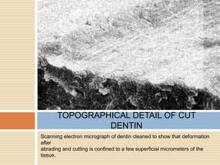 Scanning electron micrograph of dentin cleaned to show that deformation
after
abrading and cutting is confined to a few superficial micrometers of the
tissue.
TOPOGRAPHICAL DETAIL OF CUT
DENTIN
 