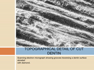 Scanning electron micrograph showing grooves traversing a dentin surface
abraded
with diamond.
TOPOGRAPHICAL DETAIL OF CUT
DENTIN
 