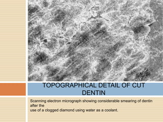 Scanning electron micrograph showing considerable smearing of dentin
after the
use of a clogged diamond using water as a coolant.
TOPOGRAPHICAL DETAIL OF CUT
DENTIN
 