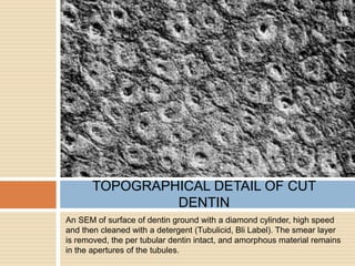 An SEM of surface of dentin ground with a diamond cylinder, high speed
and then cleaned with a detergent (Tubulicid, Bli Label). The smear layer
is removed, the per tubular dentin intact, and amorphous material remains
in the apertures of the tubules.
TOPOGRAPHICAL DETAIL OF CUT
DENTIN
 