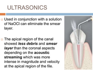 ULTRASONICS
 Used in conjunction with a solution
of NaOCl can eliminate the smear
layer.
 The apical region of the canal
showed less debris and smear
layer than the coronal aspects
depending on the acoustic
streaming which was more
intense in magnitude and velocity
at the apical region of the file.
 