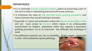 ADVANTAGES:
It is a minimally invasive surgical procedure, aimed at preserving a part of
the root to help in maintaining hard and soft-tissue contours.
 It minimizes the need of soft and hard tissue grafting procedures and
hence shortens the overall treatment duration.
Especially in canine and premolars where the buccal cortical plate is thin
and are more prone to fracture which makes it an unfavourable
environment for implant placement which also requires a secondary
grafting procedure. So as to overcome this difficulty this technique is
used.
No additional material cost, No co-morbidity , Single surgery ,Applicable
in sites with endodontic apical pathology
 