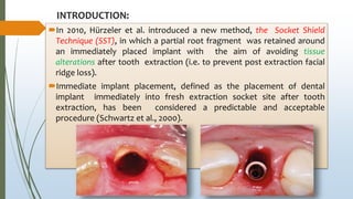INTRODUCTION:
In 2010, Hürzeler et al. introduced a new method, the Socket Shield
Technique (SST), in which a partial root fragment was retained around
an immediately placed implant with the aim of avoiding tissue
alterations after tooth extraction (i.e. to prevent post extraction facial
ridge loss).
Immediate implant placement, defined as the placement of dental
implant immediately into fresh extraction socket site after tooth
extraction, has been considered a predictable and acceptable
procedure (Schwartz et al., 2000).
 