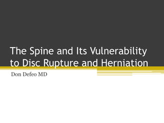 The Spine and Its Vulnerability
to Disc Rupture and Herniation
Don Defeo MD
 
