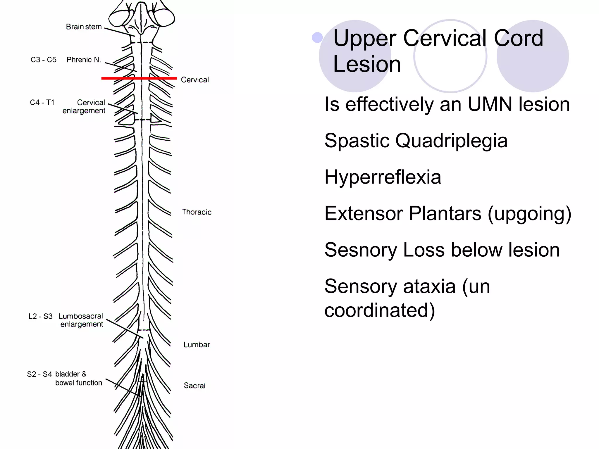Upper Cervical Cord Lesion Is effectively an UMN lesion Spastic Quadriplegia Hyperreflexia Extensor Plantars (upgoing) Sesnory Loss below lesion Sensory ataxia (un coordinated) 