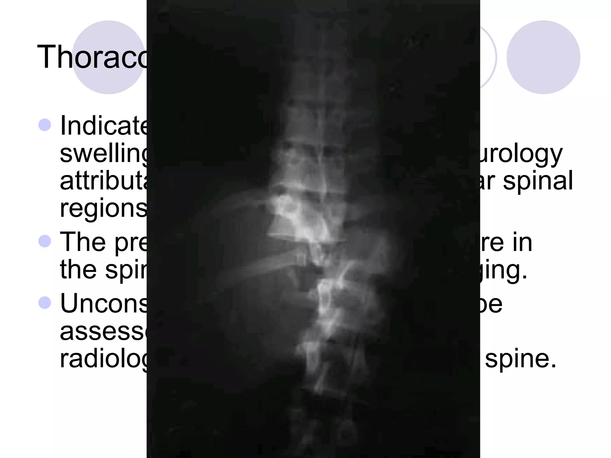 Thoracolumbar spine Indicated if there is pain, bruising, swelling, deformity or abnormal neurology attributable to the thoracic or lumbar spinal regions. The presence of a fracture anywhere in the spine mandates full spinal imaging. Unconscious patients who cannot be assessed clinically also require radiological clearance of the whole spine.  