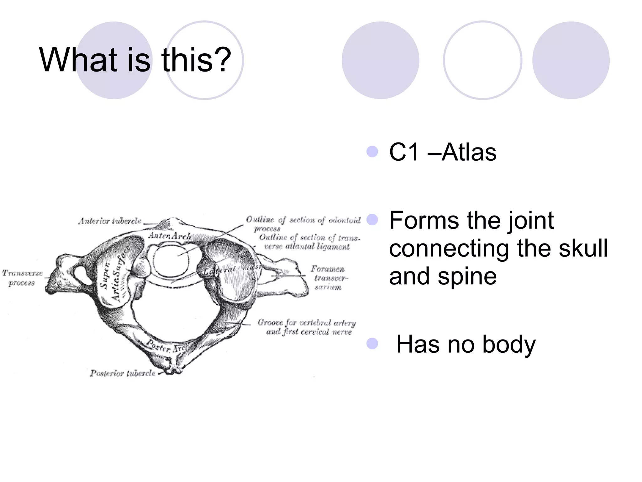 What is this? C1 –Atlas Forms the joint connecting the skull and spine Has no body 