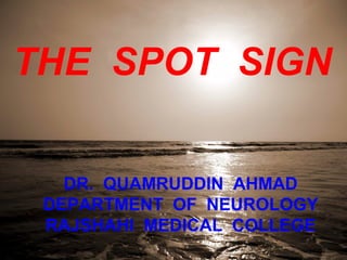 2
THE SPOT SIGN
DR. QUAMRUDDIN AHMAD
DEPARTMENT OF NEUROLOGY
RAJSHAHI MEDICAL COLLEGE
 