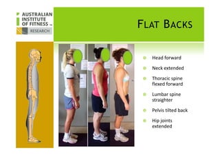 FLAT BACKS
Head forward
Neck extended
Thoracic spineThoracic spine
flexed forward
Lumbar spine
straighter
Pelvis tilted back
Hip joints
extended
 