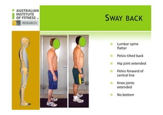 SWAY BACK
Lumbar spine
flatter
Pelvis tilted backPelvis tilted back
Hip joint extended
Pelvis forward of
central line
Knee joints
extended
No bottom
 