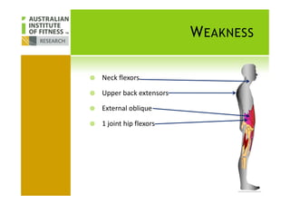 WEAKNESS
Neck flexors
Upper back extensors
External oblique
1 joint hip flexors
 