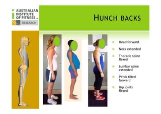 HUNCH BACKS
Head forward
Neck extended
Thoracic spineThoracic spine
flexed
Lumbar spine
extended
Pelvis tilted
forward
Hip joints
flexed
 