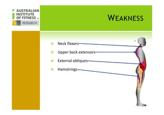 WEAKNESS
Neck flexors
Upper back extensors
External obliques
Hamstrings
 