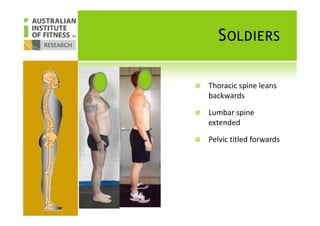 SOLDIERS
Thoracic spine leans
backwards
Lumbar spineLumbar spine
extended
Pelvic titled forwards
 