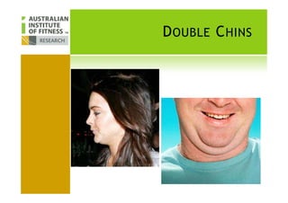 DOUBLE CHINS
 