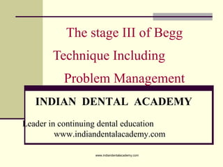 The stage III of Begg
Technique Including
Problem Management
INDIAN DENTAL ACADEMY
Leader in continuing dental education
www.indiandentalacademy.com
www.indiandentalacademy.com

 