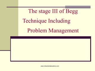 The stage III of Begg
Technique Including
Problem Management
www.indiandentalacademy.com
 
