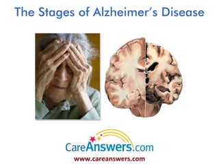 The Stages of Alzheimer’s Disease




         www.careanswers.com
 