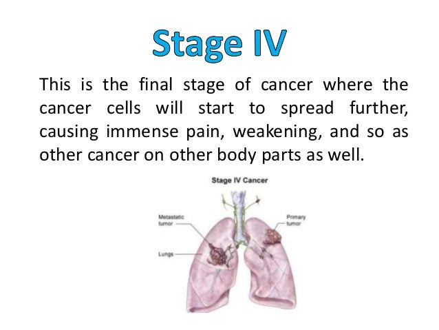 The Stages of Lung Cancer Caused by Smoking