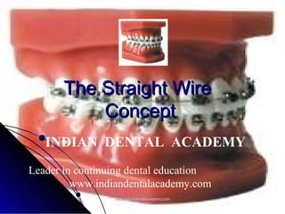 The Straight Wire
Concept
INDIAN DENTAL ACADEMY
Leader in continuing dental education
www.indiandentalacademy.com
www.indiandentalacademy.com

 