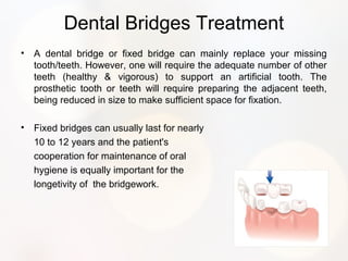 Dental Bridges Treatment
• A dental bridge or fixed bridge can mainly replace your missing
tooth/teeth. However, one will require the adequate number of other
teeth (healthy & vigorous) to support an artificial tooth. The
prosthetic tooth or teeth will require preparing the adjacent teeth,
being reduced in size to make sufficient space for fixation.
• Fixed bridges can usually last for nearly
10 to 12 years and the patient's
cooperation for maintenance of oral
hygiene is equally important for the
longetivity of the bridgework.
 