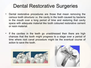 Dental Restorative Surgeries
• Dental restorative procedures are those that mean removing the
carious tooth structure i.e. the cavity in the tooth caused by bacteria
in the mouth over a long period of time and restoring that cavity
space with adequate material like tooth coloured restorative cement
or resin material.
• If the cavities in the teeth go unaddressed then there are high
chances that the tooth might progress to a stage over a period of
time where root canal procedure might be the eventual course of
action to save the tooth.
 