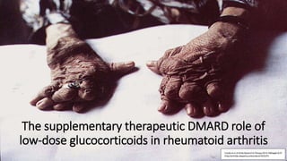 The supplementary therapeutic DMARD role of
low-dose glucocorticoids in rheumatoid arthritis
 